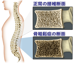 腰椎断面