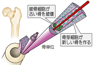 骨単位