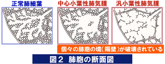 肺胞の断面図