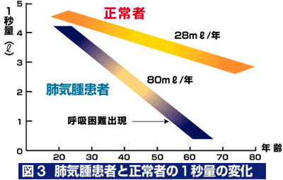 肺気腫患者と正常者の1秒量の変化