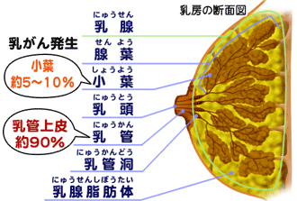 乳がん 病気の知識 介護の知識 訪問看護 24時間の在宅看護等のサービスを自費で ナースアテンダント