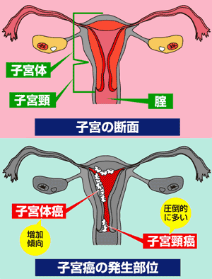 ん 検診 体 が 子宮 子宮体がん検診とは？受けるべき年齢と疾患リスクが高くなる原因